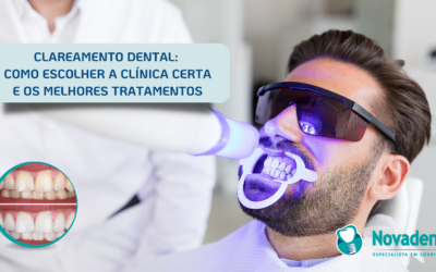 TIPOS DE CLAREAMENTO DENTAL E SEUS EFEITOS